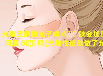 光敏皮肤做光子嫩 🦍 肤会加重问题 🦆 吗(光敏性皮肤做了光子嫩肤会怎样)